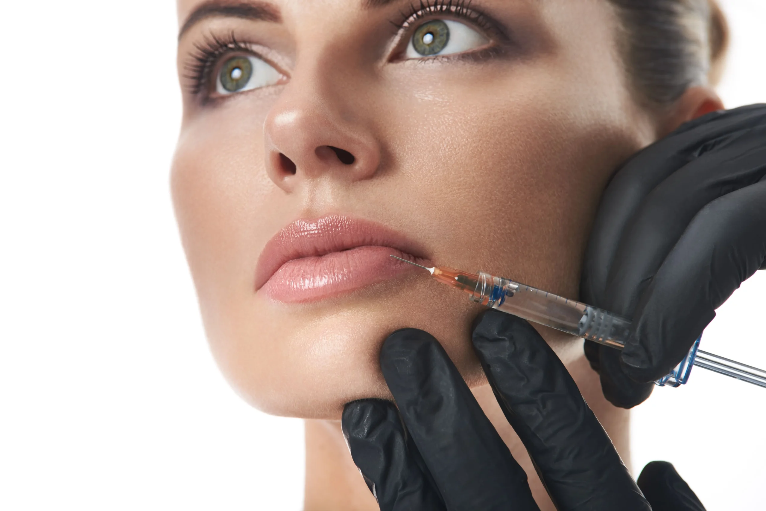 servicio relleno de labios en Vitoria relleno de labios